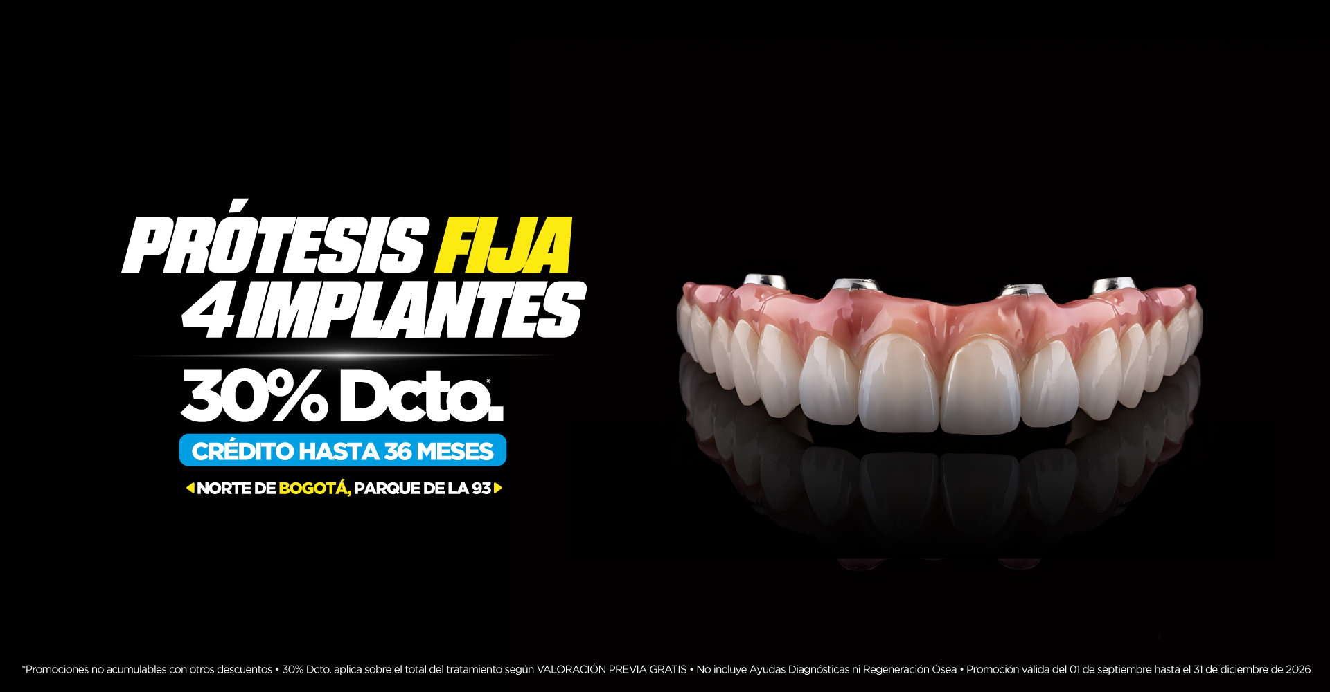 Prótesis Dental Fija Sobre 4 Implantes Prótesis Dental Fija Sobre 4 Implantes