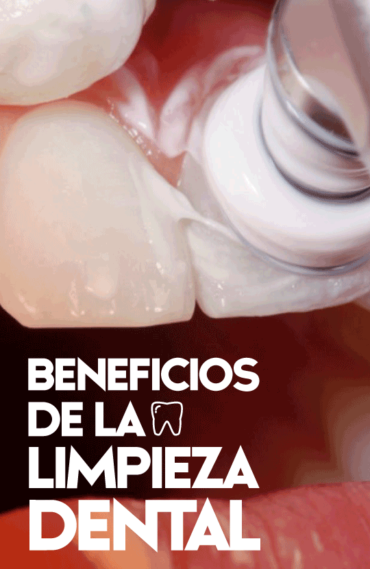 Limpieza Dental Especializada