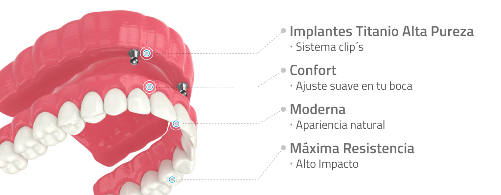 Prótesis Total con Implantes desde $5.895.000