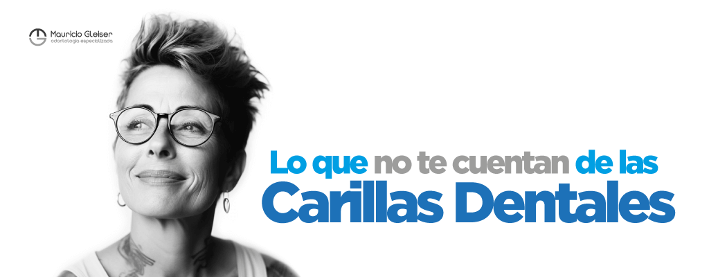 Lo que no te cuentan de las Carillas Dentales