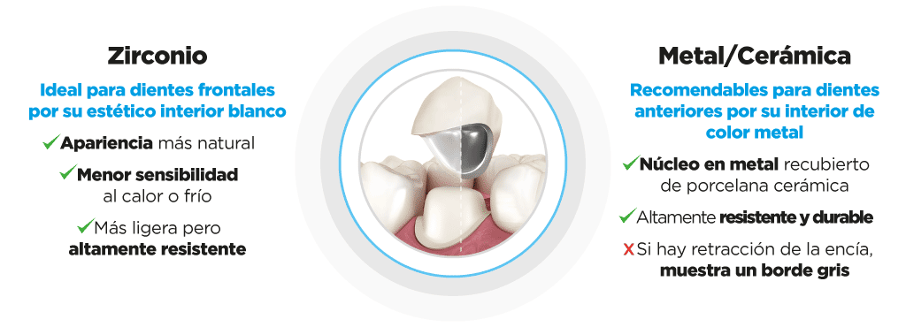 Coronas Dentales en Zirconio y Metal - Cerámica 100% Cerámicas